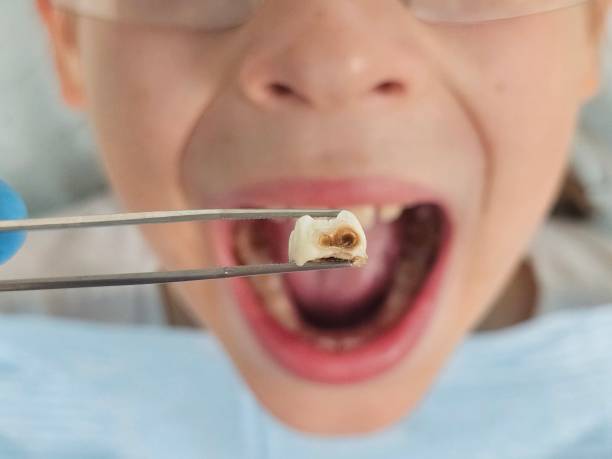 Best Urgent Dental Care  in Harrison, TN